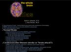 Brain Atlas (Harvard University)
