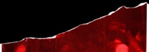 27ème Journée de Neuropsychologie aux Vignes : Tauopathies, mouvement & cognition. Imagerie & renouveau des amnésies.